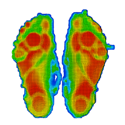 Fußdruckanalyse Scan
